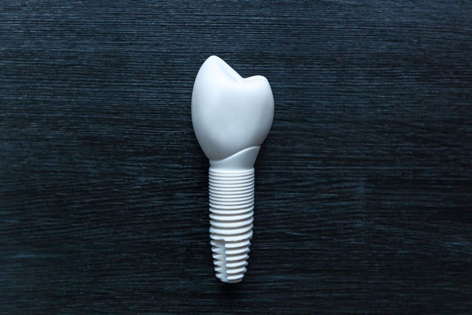 an image of zirconia dental implants